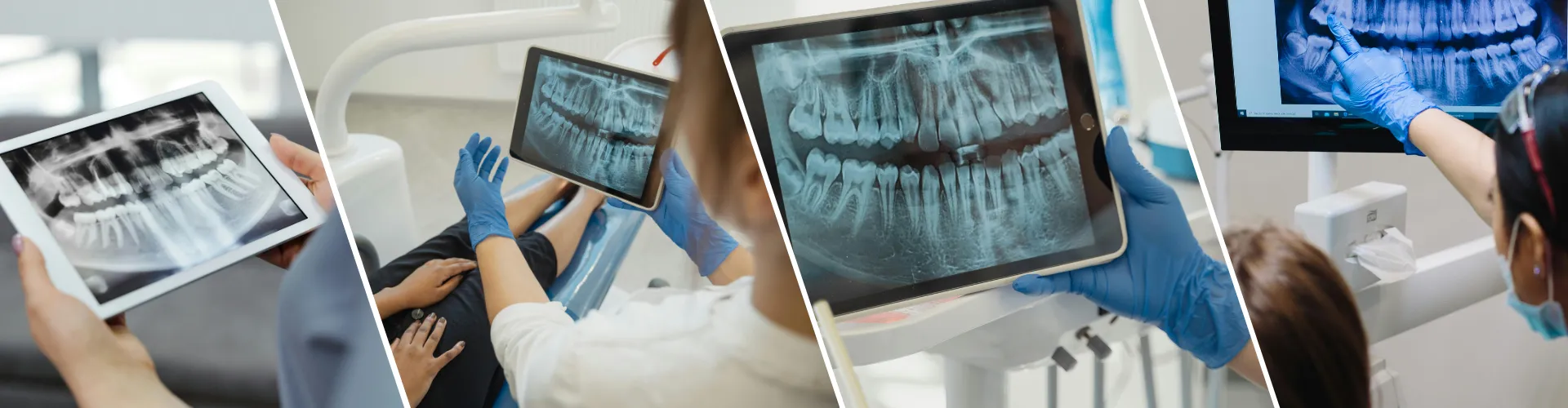 Dental X-rays